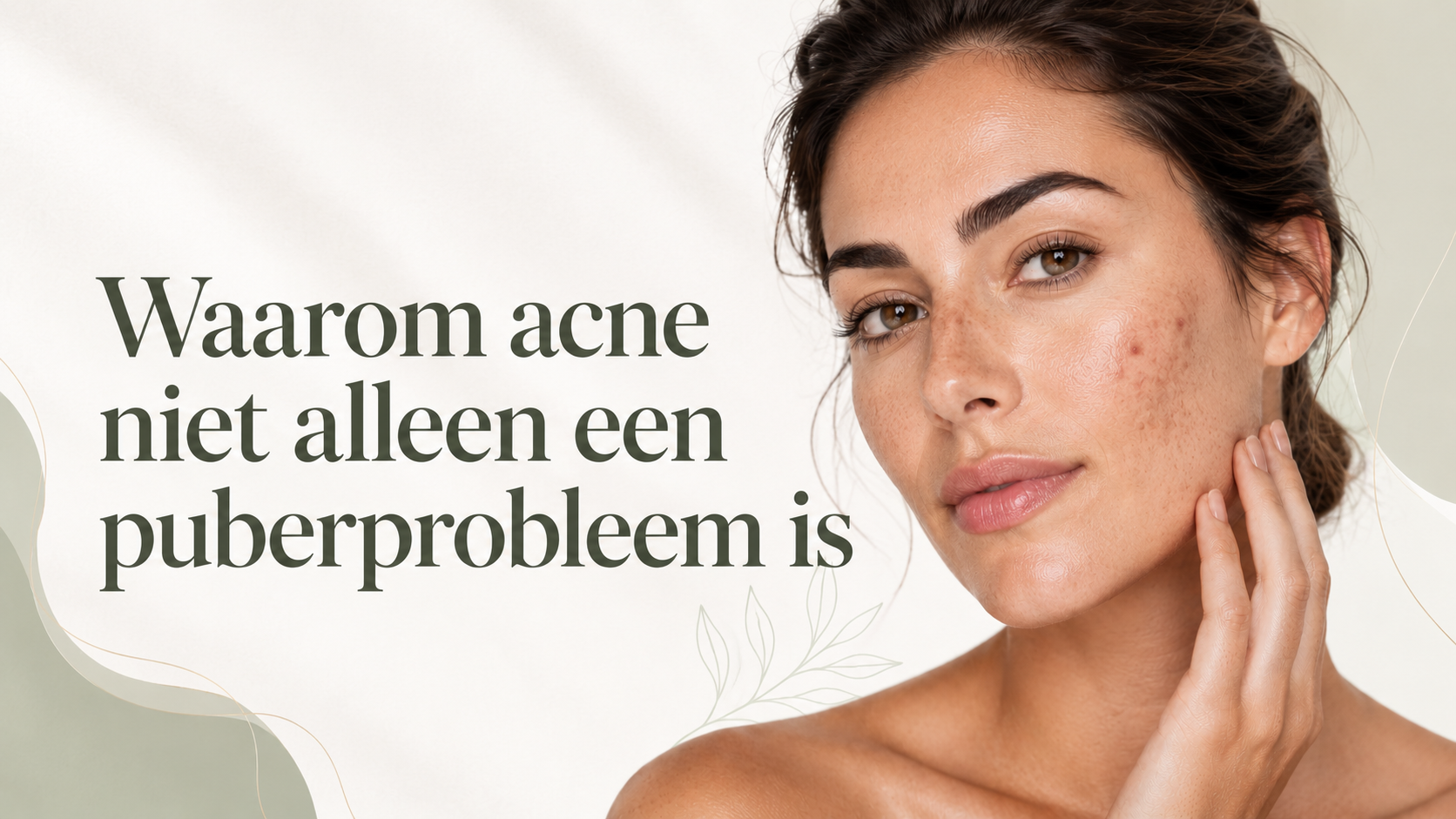 Waarom acne niet alleen een puberprobleem is