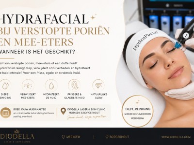 HydraFacial bij verstopte poriën en mee-eters: wanneer is het geschikt?