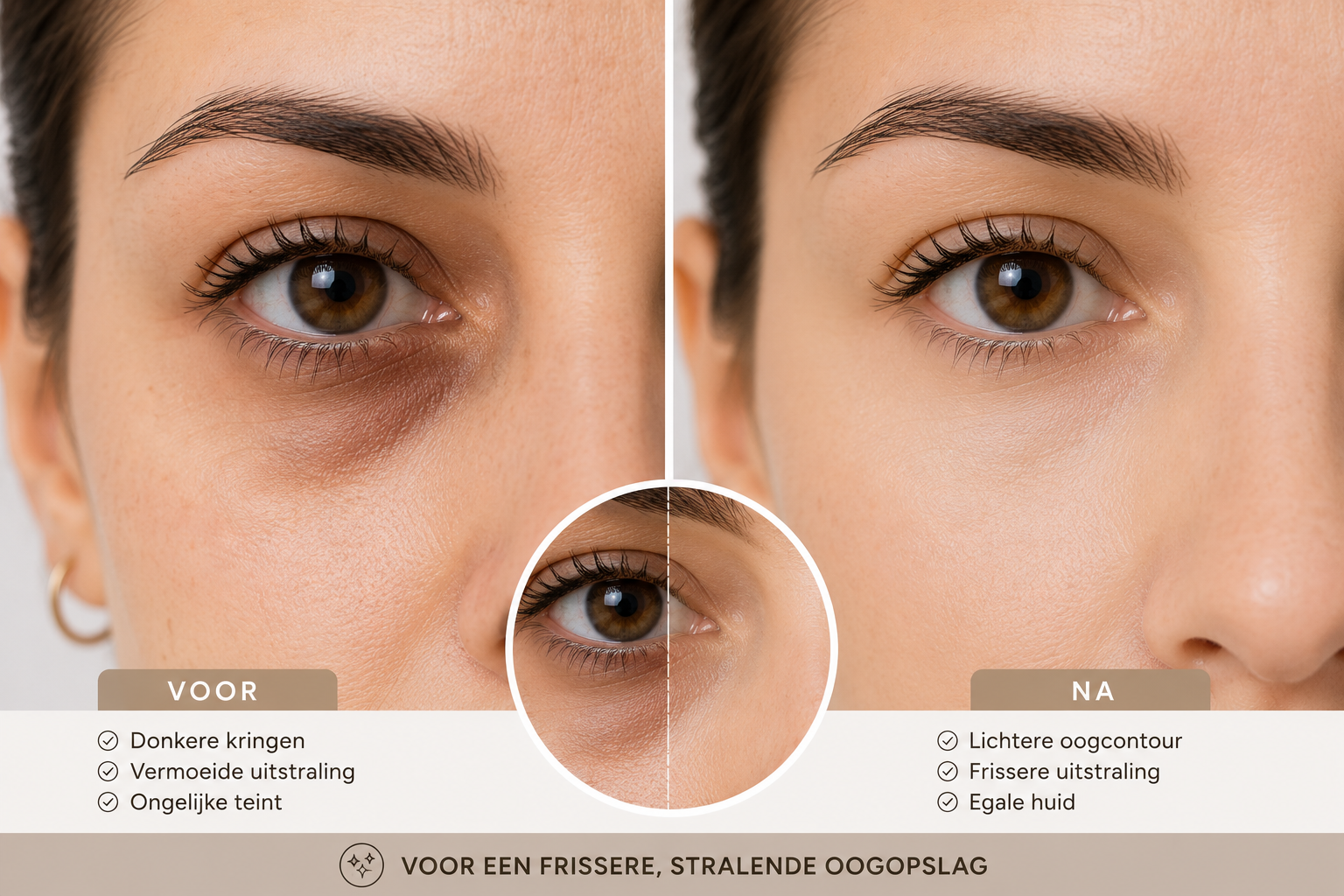 Donkere kringen onder de ogen: oorzaken, verzorging en behandelingen