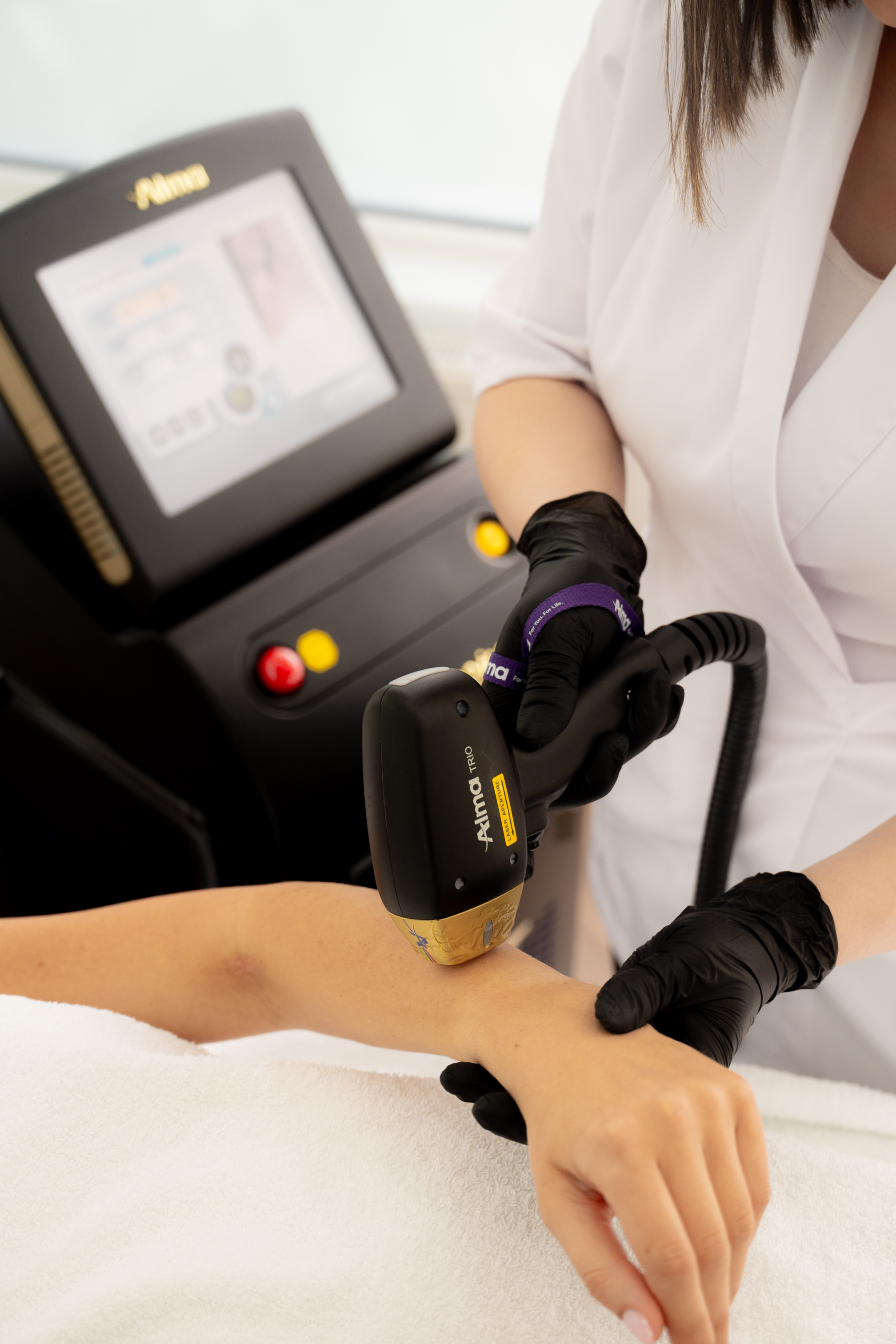 laserontharing vrouwen-benen